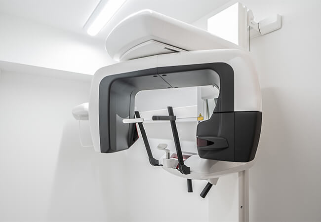 マウスピース型矯正装置における歯科用CTの活用